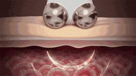 杨幂做了什么医美,杨幂新氧医美