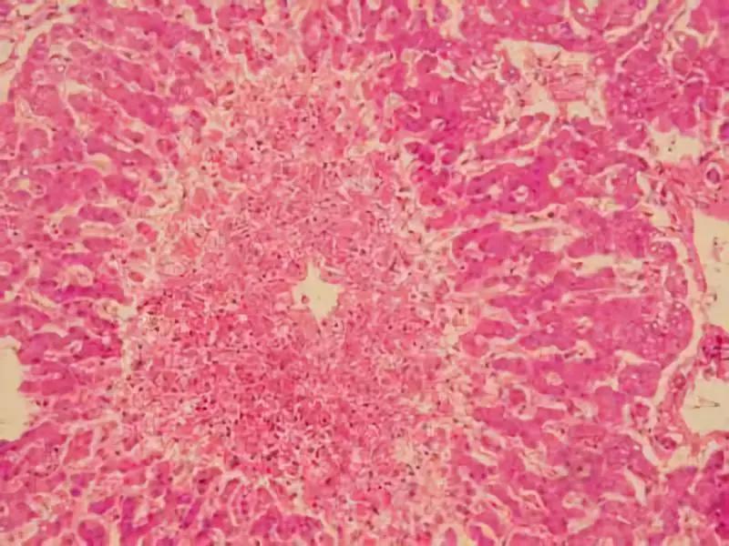 身体痒艾叶煮水洗澡,皮肤病怎么用艾叶洗澡呢