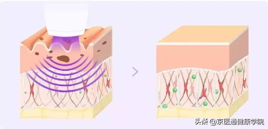 被吹上天却没什么用的保健品,被吹上天的阿胶