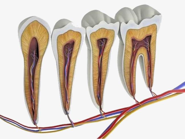 牙齿上了杀神经的药一般会疼几天,牙齿一咬东西就疼治疗多少费用