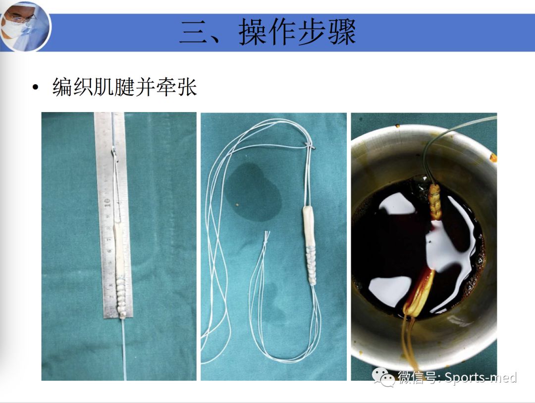 案例分享痴迷足球的十六岁男孩如何战胜十字韧带伤痛重返赛场