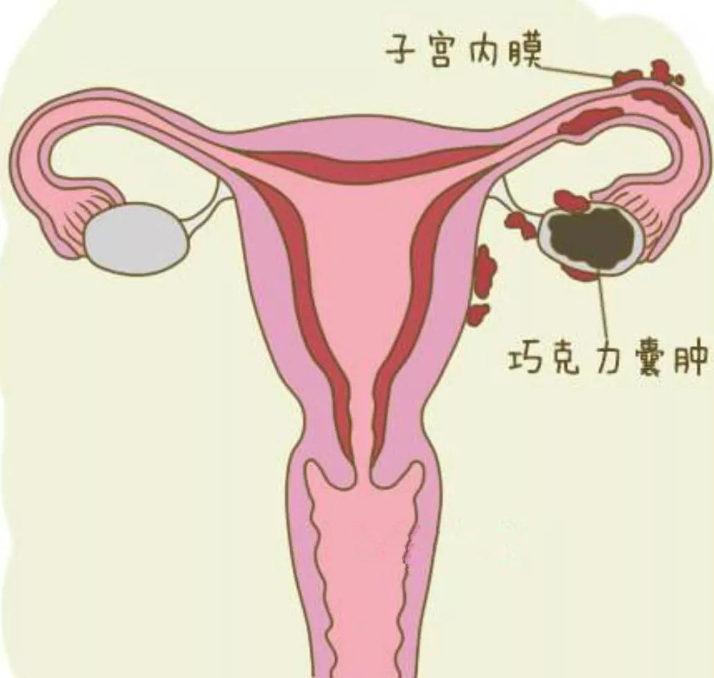 妇产科死亡率最高的癌,妇产科医生谈良性癌症