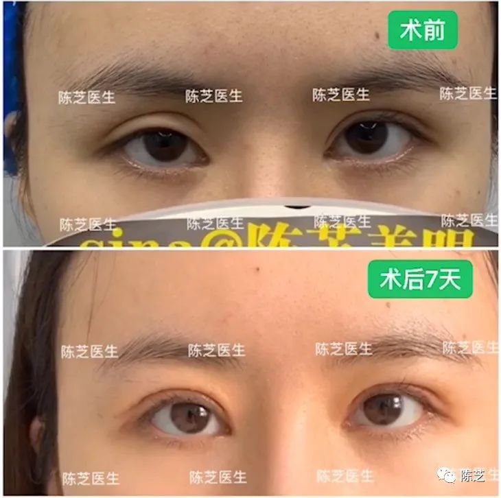 明明年纪不大却很显老态,明明年纪很小但是脸很显老