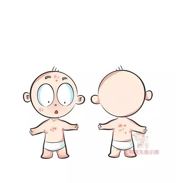 荨麻疹湿疹发病原因及治疗方法,热疹皮疹湿疹有什么区别