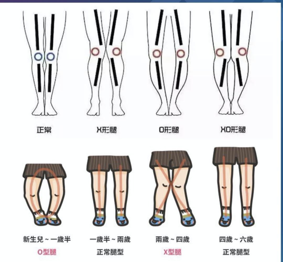 女明星腿精大赏：o型腿也能变成腿精