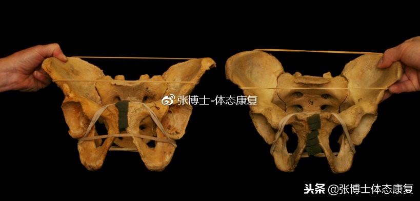 膝内扣和膝外翻是一回事吗,下蹲如何避免膝盖内扣
