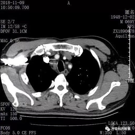 怎么应用统计学做调查,统计学方法可以解决的主要问题