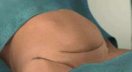 明明怀孕为什么宫内没有孕囊,明明有宫缩为什么医生说没有