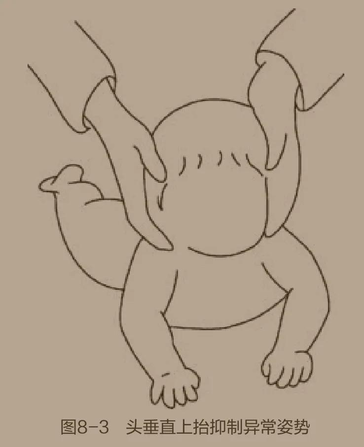 为爱行儿童康复中心小儿颈软抬不起头的训练方案：头部的控制