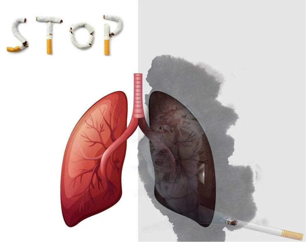 肺结核有什么不能吃的食物,肺结核不能吃什么食物