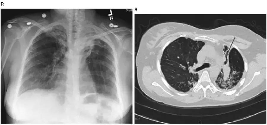 胸部影像解剖图谱书,胸部断层图谱
