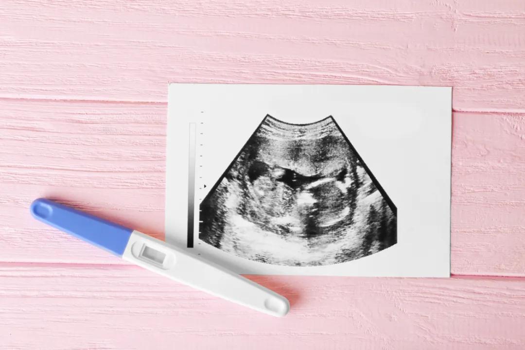 重庆整个孕期产检费用一般多少,重庆孕妇检查费用表