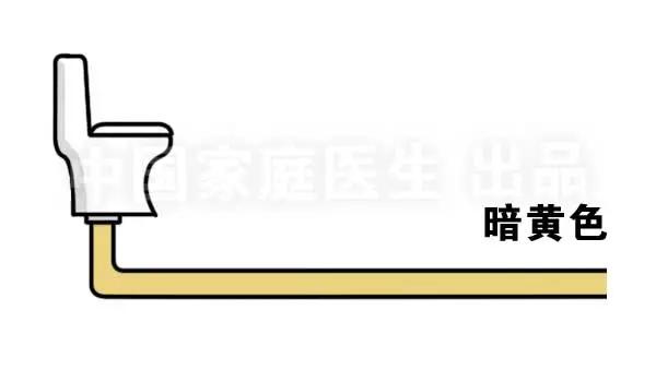 肝肾出现问题所表现的综合征,上厕所有四个症状说明肝有问题