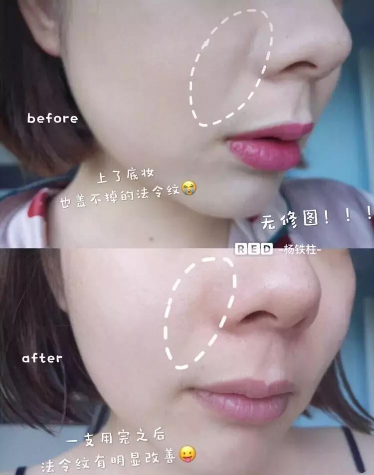 theordinary护肤品推荐,护肤圈成分theordinary