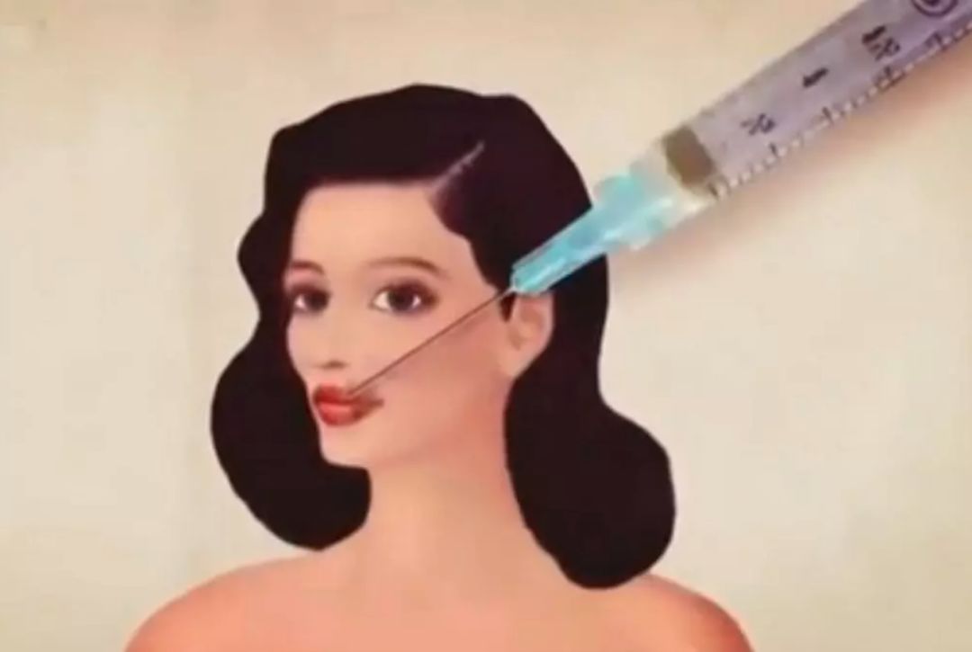 为了变美我们都做了哪些动作,为了变美疯狂整形