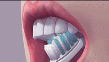 什么是牙髓炎牙髓炎可以自愈吗,什么是牙髓炎要根治吗