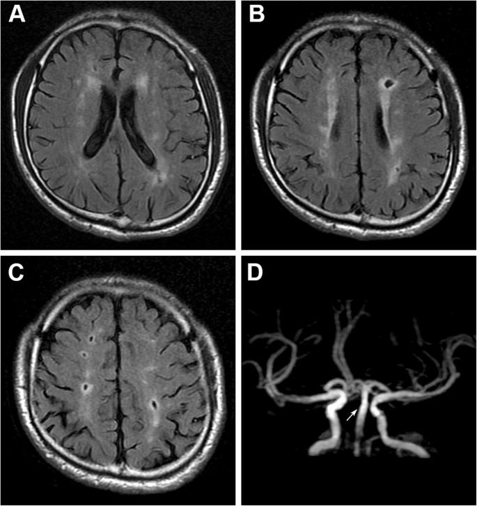 大脑的病症好治吗,大脑疾病怎么治好得快一些