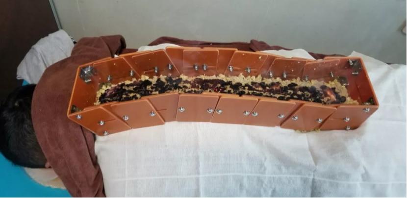 感冒对症治疗简易图表,感冒用什么方法来治呢