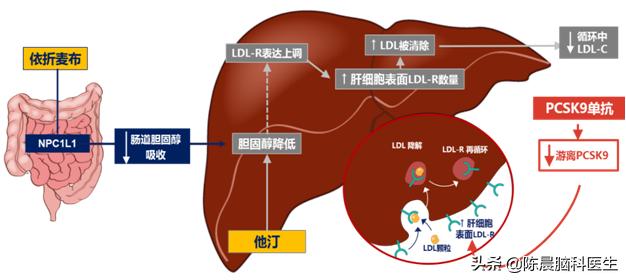 动脉粥样硬化闭塞症药物上市,动脉粥样硬化斑块能够药物消除吗