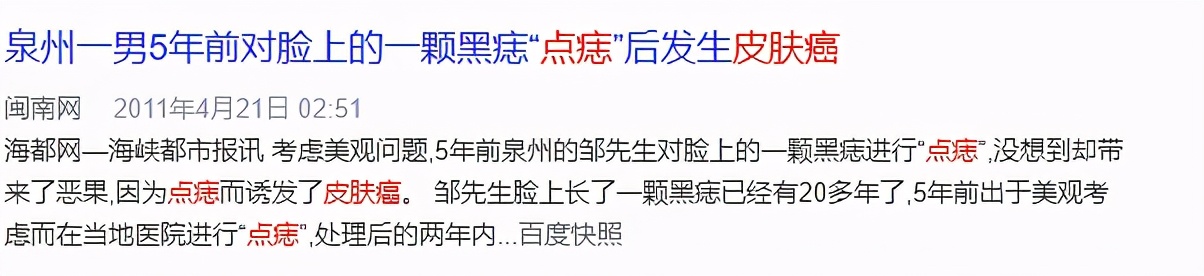 身上长这2种痣的人要警惕,脖子右后方有痣的各个部位详细图