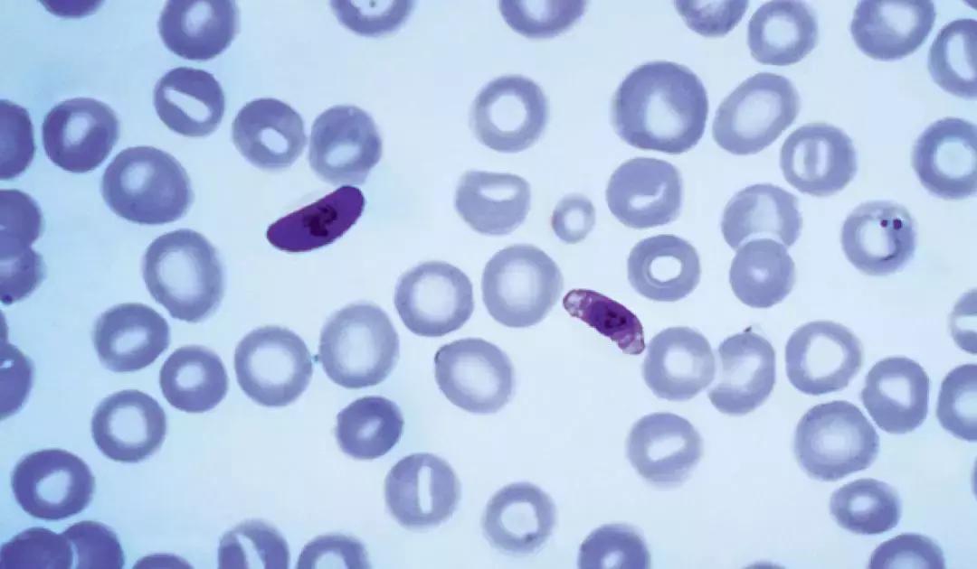 疟原虫抗癌疗法,疟原虫怎么治疗癌症