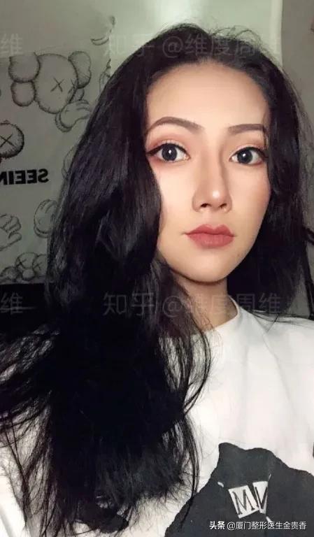 鼻子变挺的方法,想要鼻子变挺去哪里好