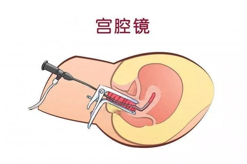 子宫肌瘤一般多大会出现临床症状,子宫肌瘤常见临床表现及治疗方案