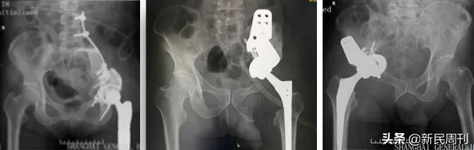 良医救治癌症,良医救治髓性白血病的发现者