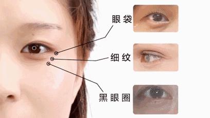 真牛！松弛老态的眼周，都被“马应龙”治住了