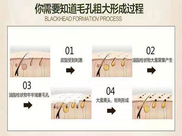 去黑头收缩毛孔简单有效方法,想要去黑头收缩毛孔用什么