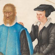 金毛狮王头发是什么根,金毛狮王的头发怎么处理