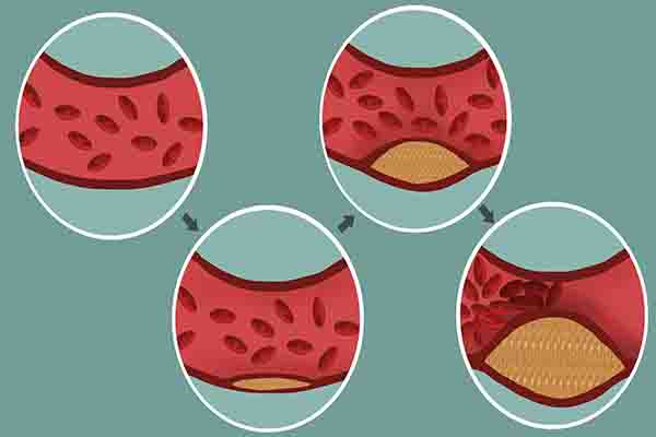 每天坚持喝绿茶，对身体有四大好处，但有“3不宜”，喝错反伤身