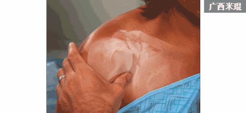 骨科大夫米琨为您详解:关节痛了怎么办?