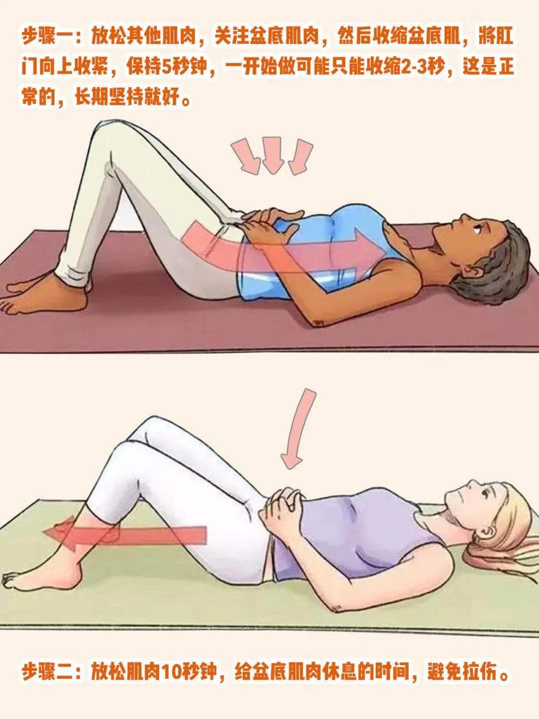 盆底肌修复凯格尔运动,孕妈妈产后康复训练