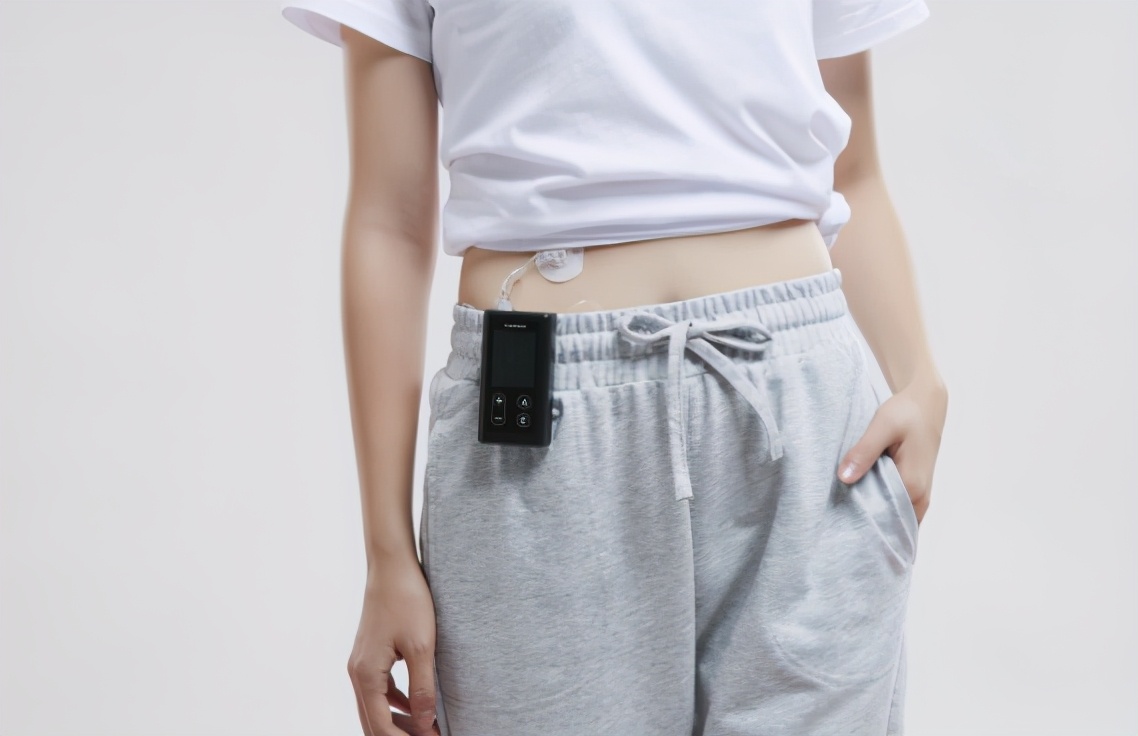 凯联乐胰岛素泵靠谱吗,进口的胰岛素泵有优惠吗