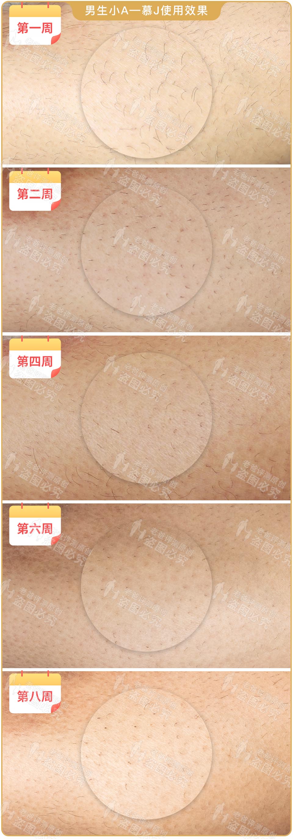 最真实的脱毛仪,bequeen脱毛仪实测