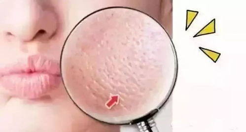 护肤品真的能缩小毛孔吗,护肤品对毛孔收缩真的有用吗