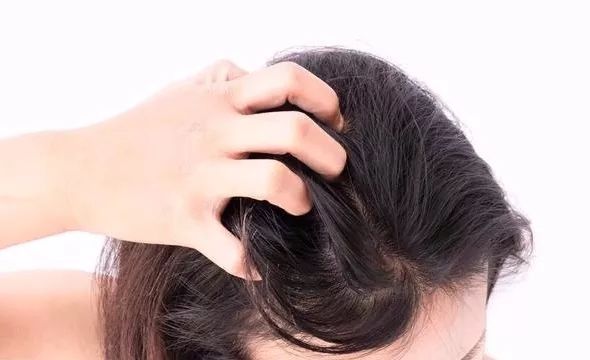 墨雪洗发水头屑越洗越多,头屑越洗越多越严重