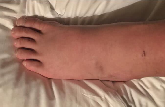 一龙崔洪万被泼冷水,一龙ko崔洪万全部视频