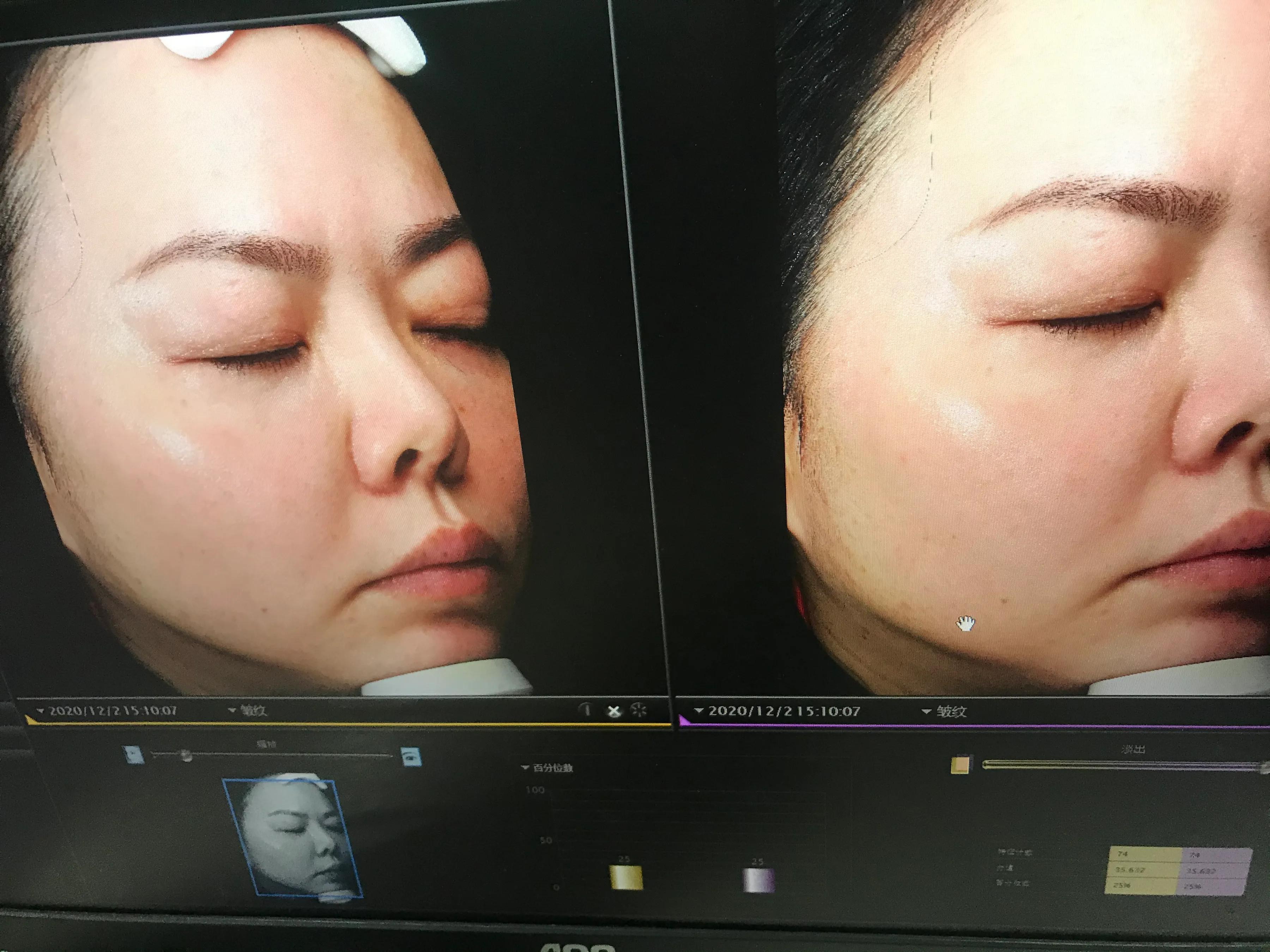 玉兰油大红瓶和sk2哪个好用,玉兰油大红瓶和sk2大红瓶比较