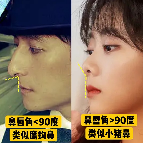 好看的鼻子类型驼峰鼻,好看的鼻型有哪几种