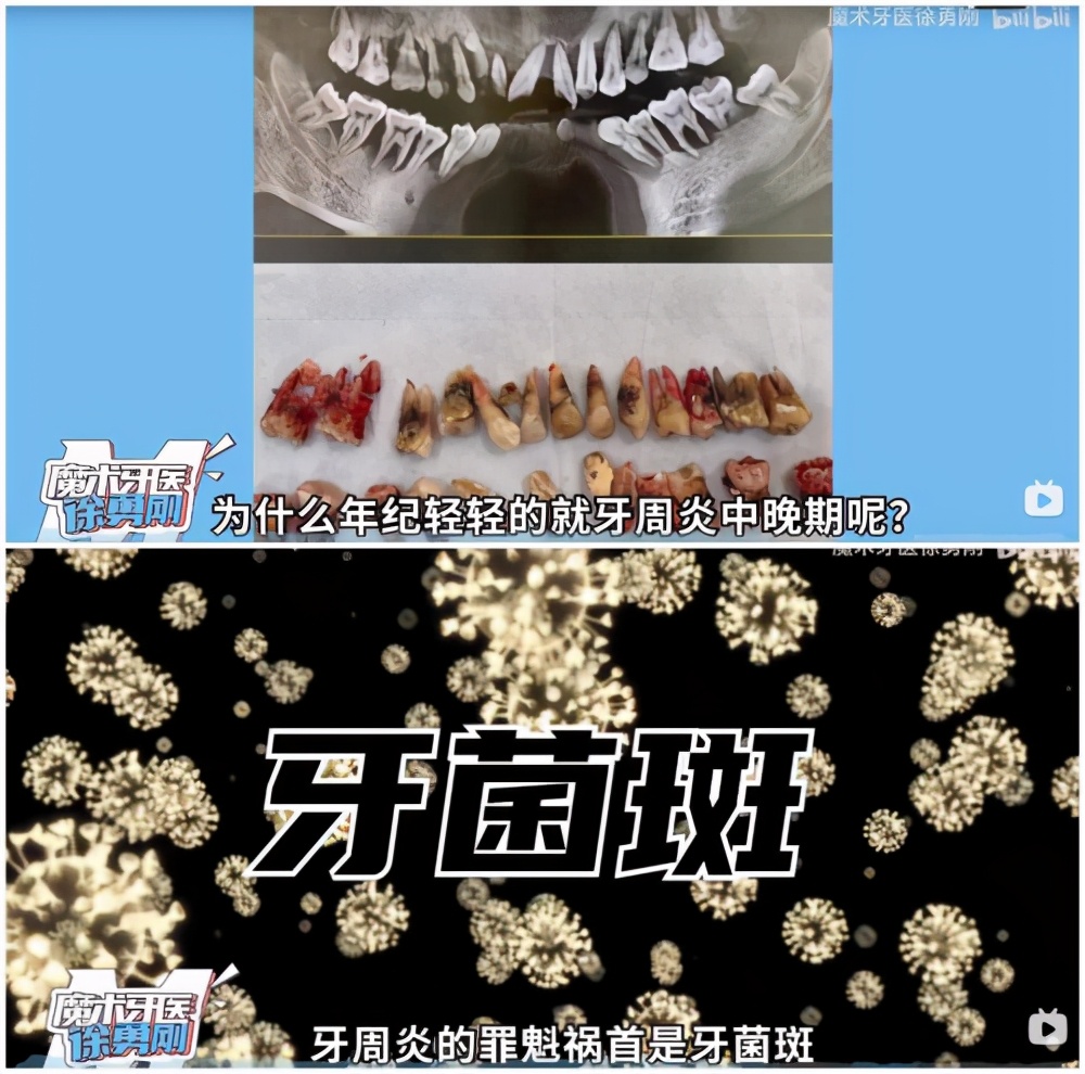 小米素诺声波洁牙仪拆解,素诺可视超声波洁牙仪t11pro价格