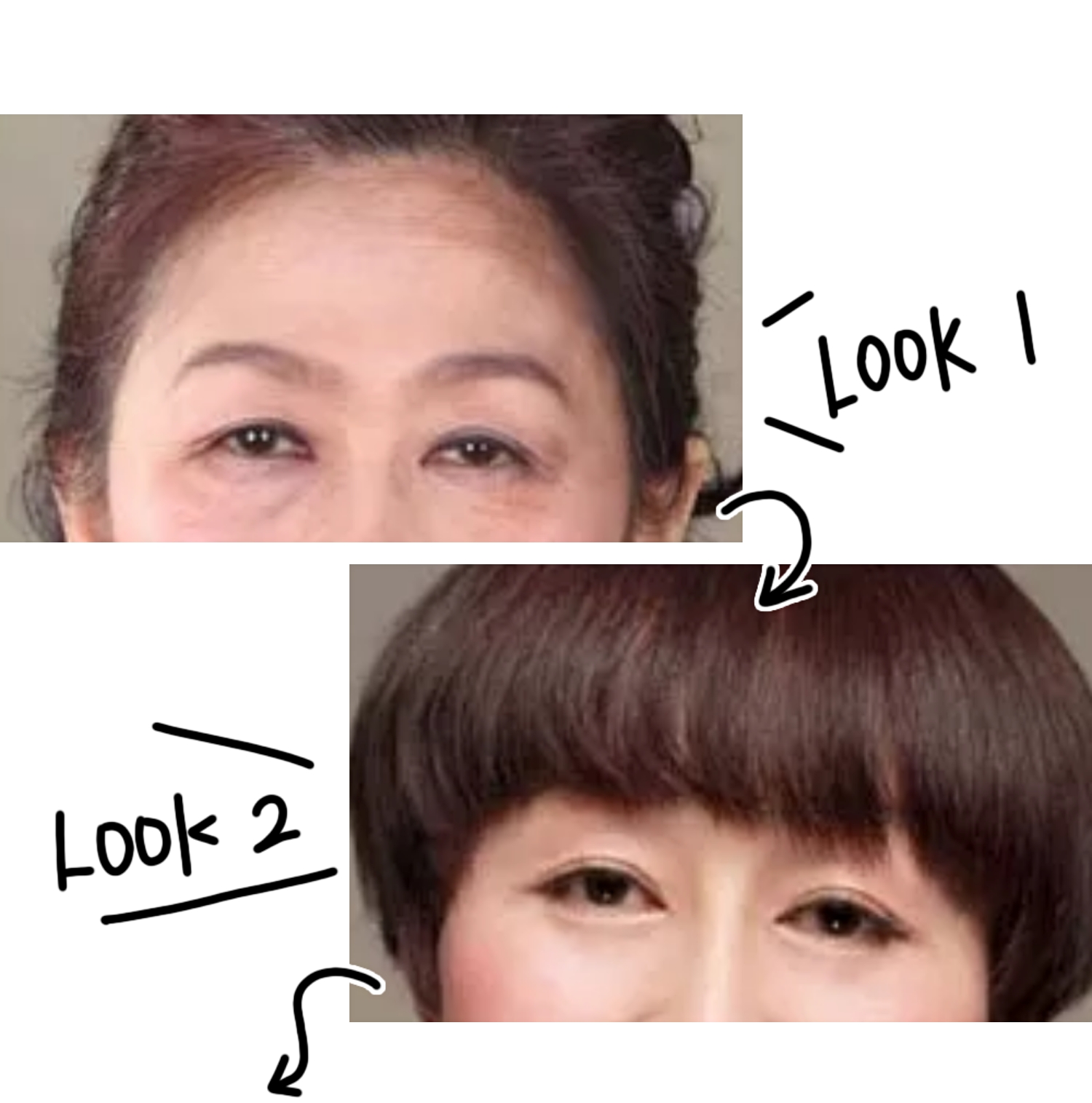 鱼尾纹眼袋怎么去除最有效,眼袋鱼尾纹怎么去除简单方法