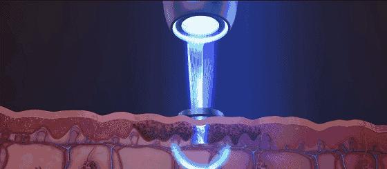 医美皮肤科医生怎么学,皮肤科医生介绍医美项目