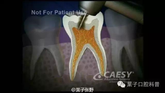 上牙龈上火突出一个鼓包,牙龈肿胀鼓包上火了吗