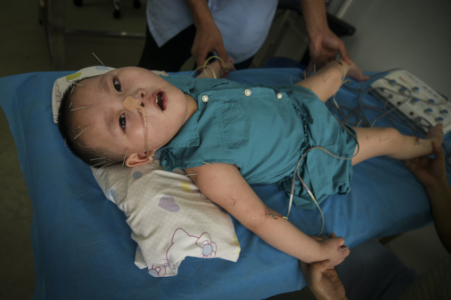 女婴患重症耽误治疗变“植物人”，母亲又患精神分裂一把火烧光家