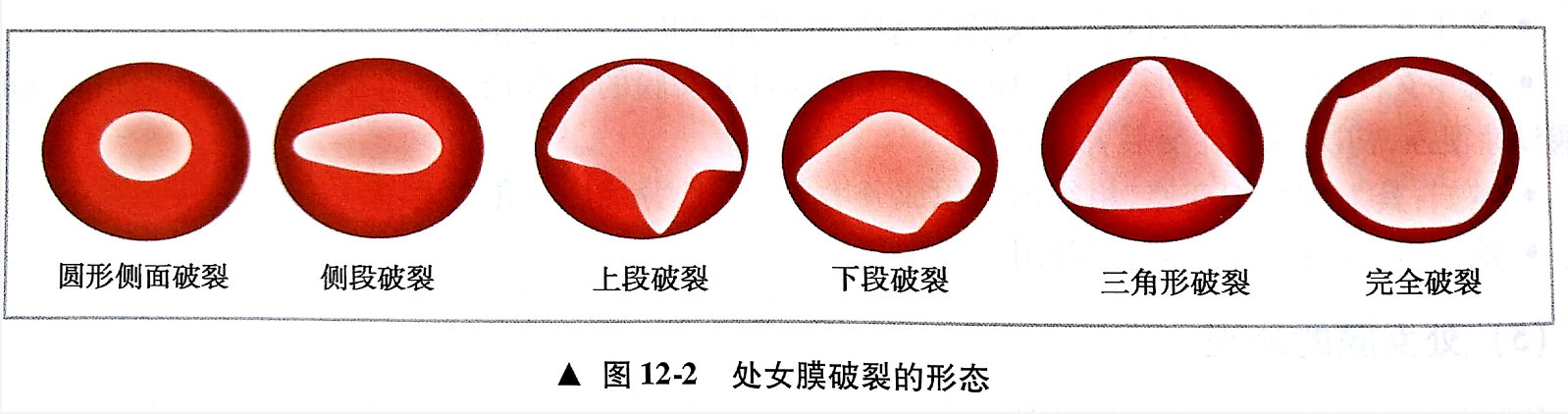 初次*生活性**不出血是否意味着女性不“纯洁”么？