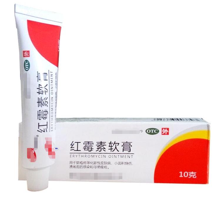 胖宝宝褶皱处红了怎么办,宝宝胖嘟嘟的脸就是好看