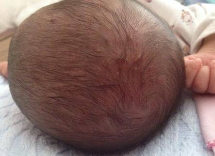 孕晚期怎么吃鹅蛋能更好的去胎毒,孕晚期怎么吃鹅蛋去胎毒