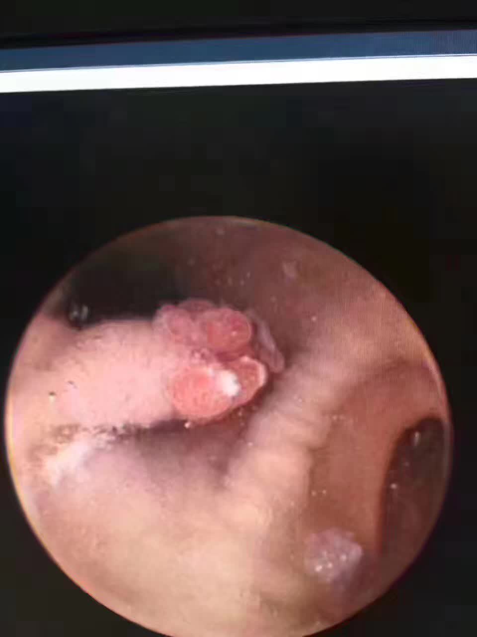 胃不舒服了不想做胃镜怎么办,胃不舒服检查是ct还是胃镜